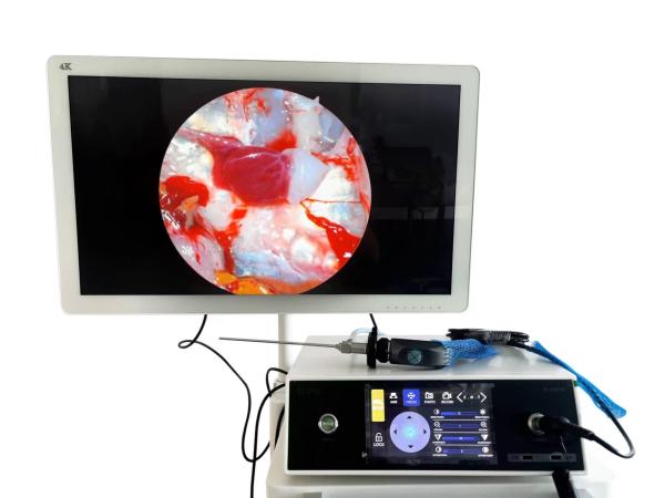 TUYOU Laparoscopy Machine Full HD Manufacturers For Left Hemihepatectomy Spine And ENT