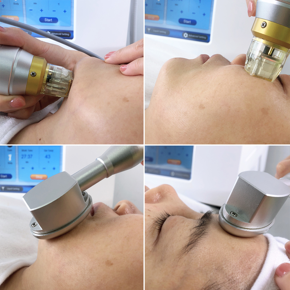 Морщинка профессиональной секретной двухполярной частичной машины RF Microneedle анти-