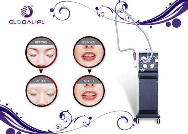 Máquina profissional 1500W da remoção do laser do cabelo da pigmentação refrigerar da água/ar