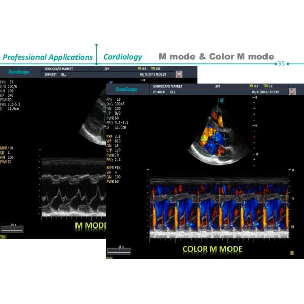 Stock SonoScape S22 ultra 5G Ultrasound Machine, Wireless Ultrasound for Veterinary Ultrasound Diagnosis