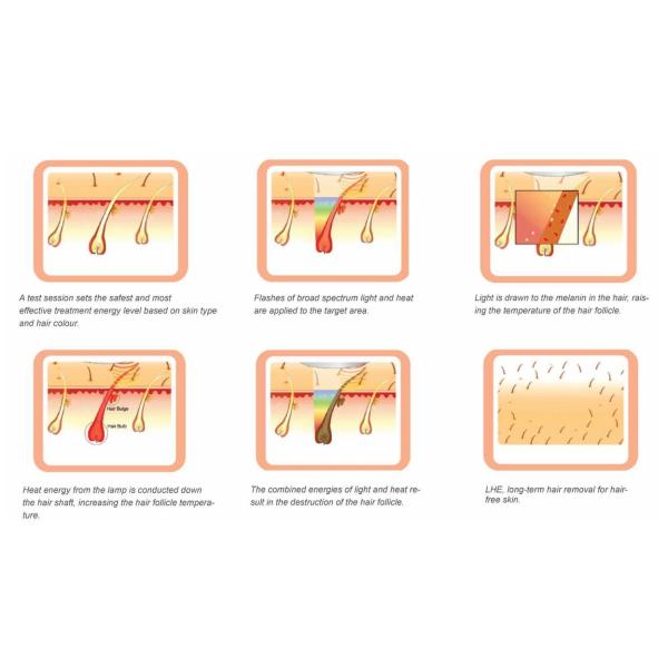 Multifunctional Nd Yag Laser Hair Depilation Machine IPL E Light High Efficiency