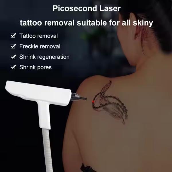 2In1 Nd Yag Pico épilation de tatouage haute puissance 1500W-3600W glace de platine 808Nm 808 Diode Laser épilation machine