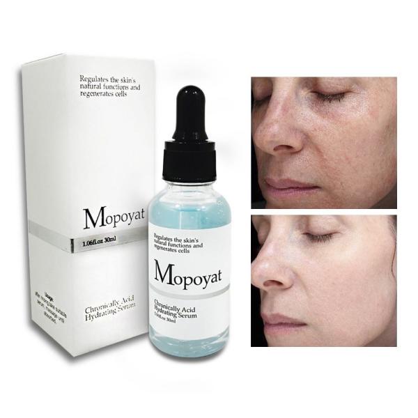 Mopoyat hyaluronic Acid Serum