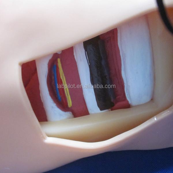 Advanced PVC Manikin for Nursing Training of Pleural Puncture Drainage and Thoracentesis