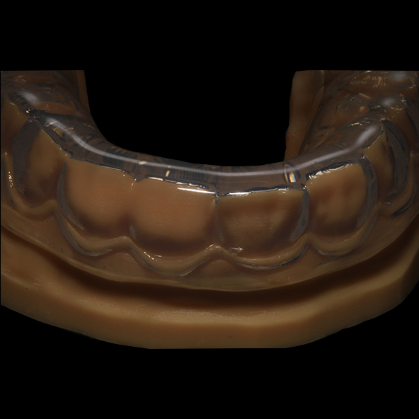 Digital Dental Lab | Clear Soft Night Guard Occlusal Splint Breathability Heavy Duty Protection