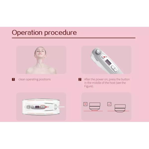 lf-424 Home use hifu machine mini hifu 0 consumables and no need to replace cartridge