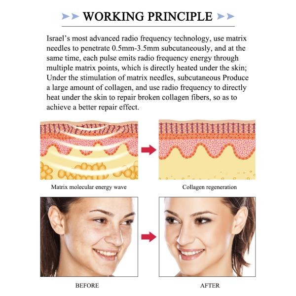 equipo de spa de salón de belleza de radiofrecuencia fraccionada máquinas faciales máquina de masaje de contorno corporal rf