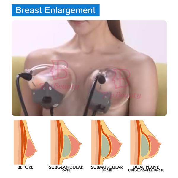 Переносное вакуумное увеличение груди для формования тела