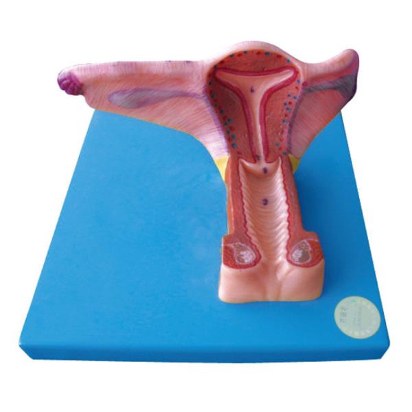 Female Inner Genital human Organ Model with 19 Positions are Displayed for Training
