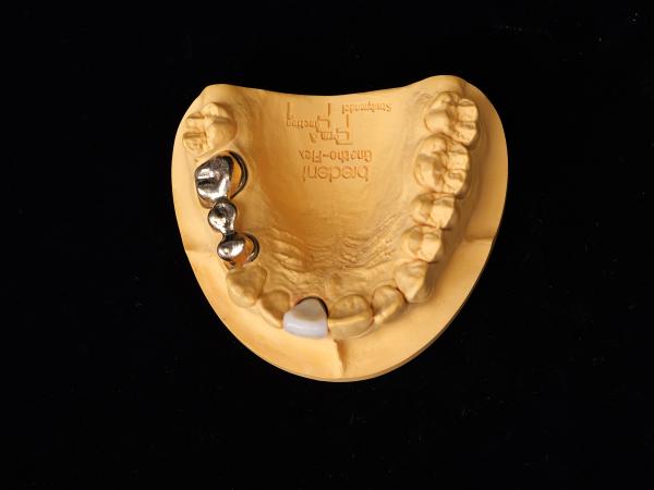 Audental 90 Dental Restorations High Noble Alloy , Dental Ceramic Alloy Yellow Au89.5%