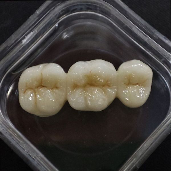 Ceramic Zirconia Dental Lab Crown Custom Anterior Posterior Teeth Replacement