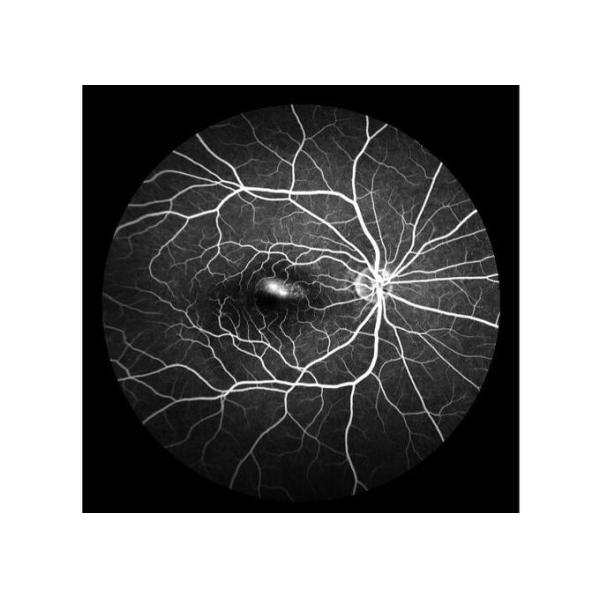 Оборудование камеры Fundus сканирования лазера профессиональное офтальмическое с Fundus отображая размер зрачка FOV 160° минимальный 2 mm