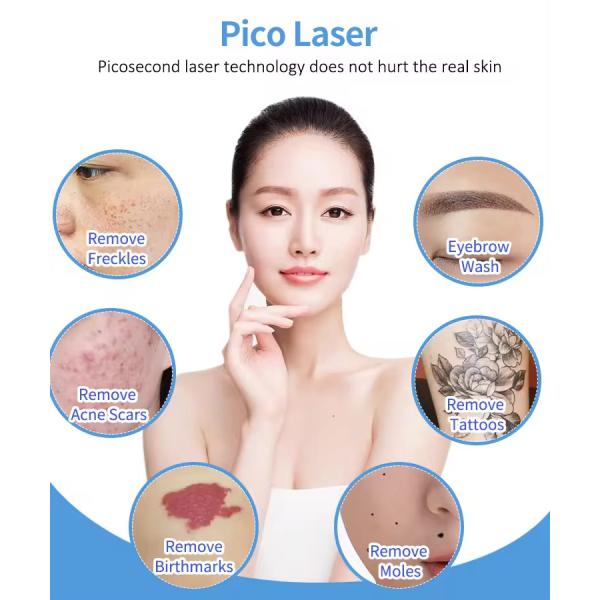 810nm 808nm Diode Laser Hair Removal Machine Laser Whitening Machine