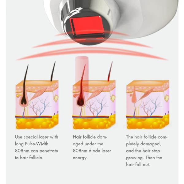 Professional Permanent IPL Hair Removal Machine 808nm Diode Laser Skin Rejuvenation Machine