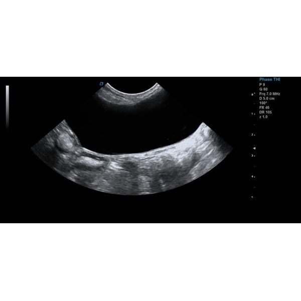 15'' LCD Portable Veterinary Ultrasound Machine 2D Gray Scale Imaging