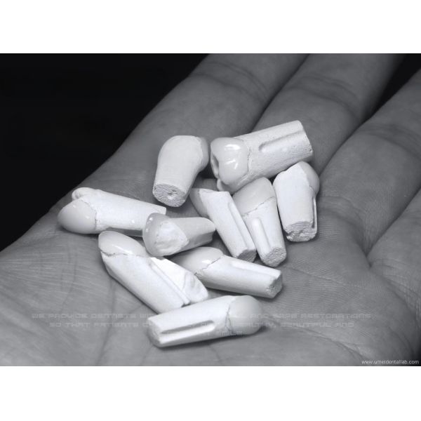 Zirconia Ceramic Veneer Natural White