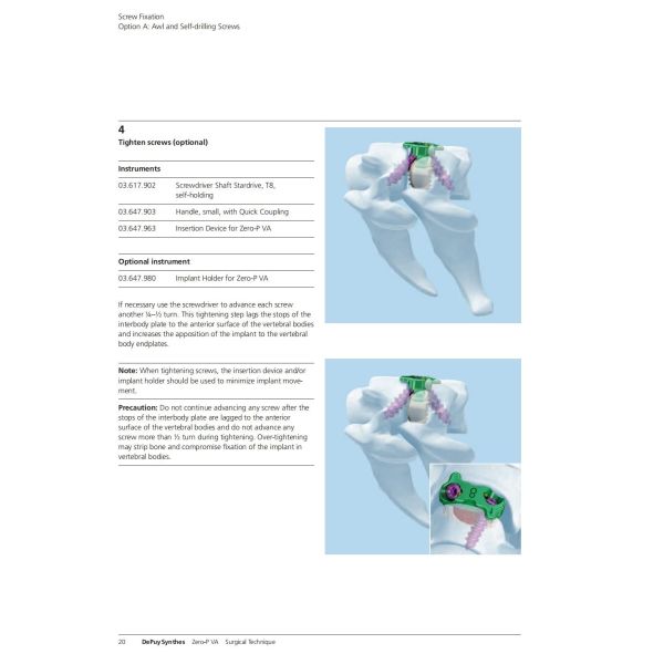 Sterilization 2 Screws Zero Profile Cage Anterior Cervical Cage Stand Alone CE Spinal Surgery