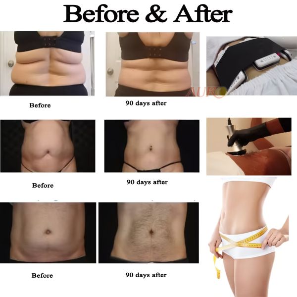 40K Cavitation Slimming Machine , RF Vacuum Lipo Laser Machine For Body Shaping