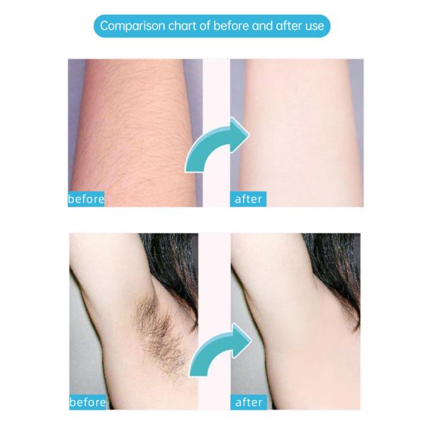 Tear-Resistant Non-Woven Epilating Roll for Body and Facial Hair Removal