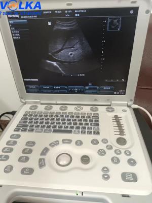 Sistema portátil de ultra-som original Mindray M7