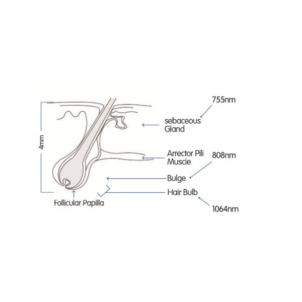 Nubway 755nm alex laser 808nm 1064nm triple wavelength diode laser machine for hair removal