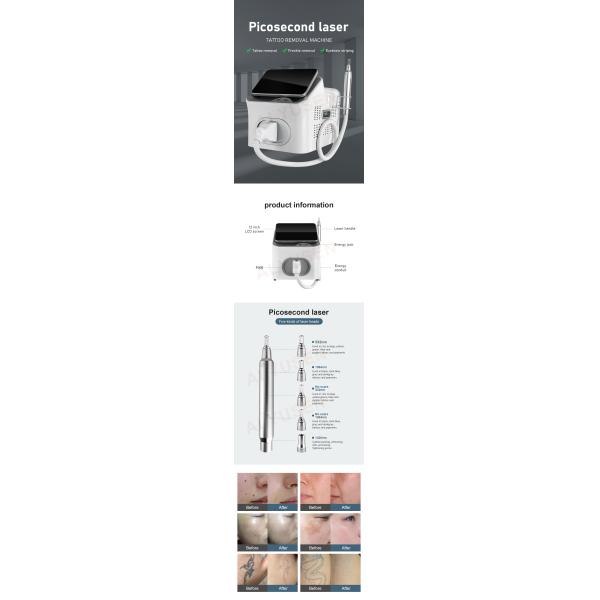 Портативный пико лазер пикосекундная лазерная пикосекундная лазерная машина для удаления татуировки татуировка Удаление 1064nm пикосекунды