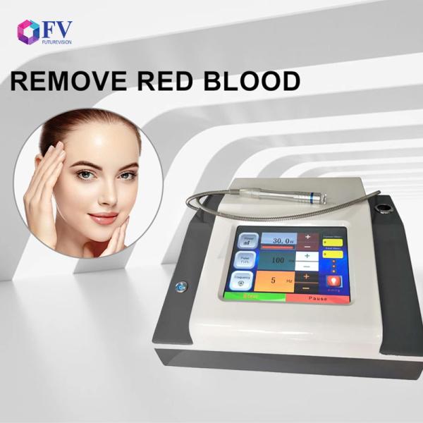 Professional 980nm Spider Vein Removal Machine – 60W Medical Laser Therapy for Flawless Skin!