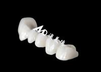 Una corona dental de Zriconia de arco completo con una apariencia natural asombrosa