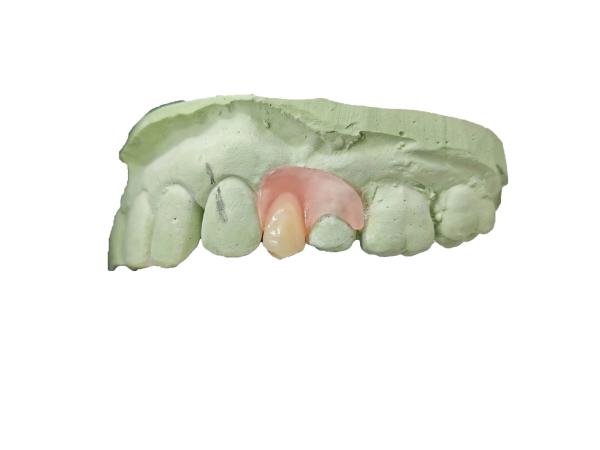 Flexible Resin or Hard Resin Elastic Resin Offers the Best Elasticity and Softness for Invisible Braces