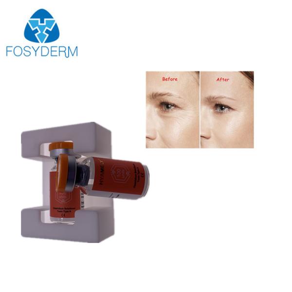 toxina 2.5ml Botulinum salina para o anti enrugamento da cara