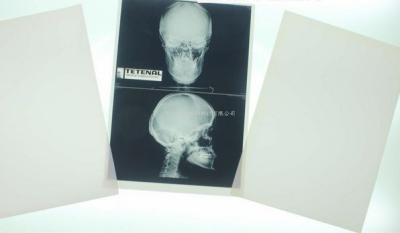 Konida 10in x 12in X Ray Medical Imaging
