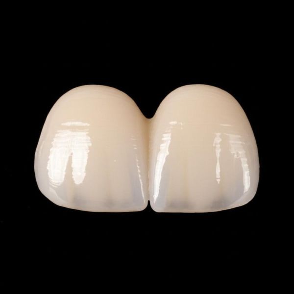 Restauration orale par placage en porcelaine