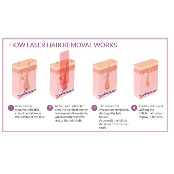 810 нм Депилатор Титановый Диод Лазерная Машина Красоты 3 Волны Удаление волос Пико Лазерная Удаление Татуировки