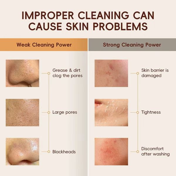 Crema Facial Limpiador Facial Limpieza Suave Hidratante Iluminador Reparación de Poros Reducción de Puntos Negros Limpiador Sedoso