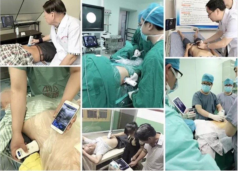 Usg New Look 3d Image GYN Image Laptop Ob Gyn Fetal Ultrasound Machine Color Doppler With High Quality