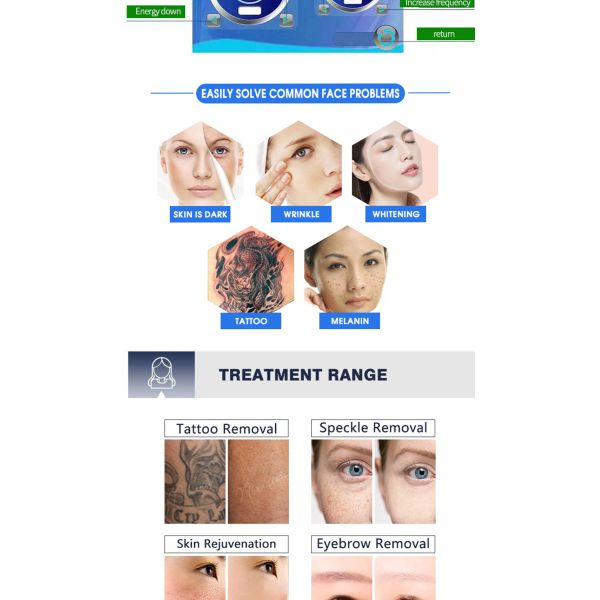 La peau Pico Carbon Facial Laser Machine tatouent le retrait 1064nm 532nm 1320nm