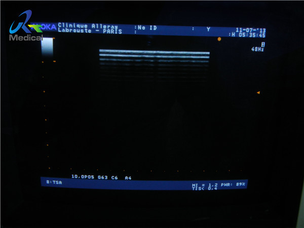 10Mhz высокочастотный линейный зонд, датчик линейного массива UST 5546