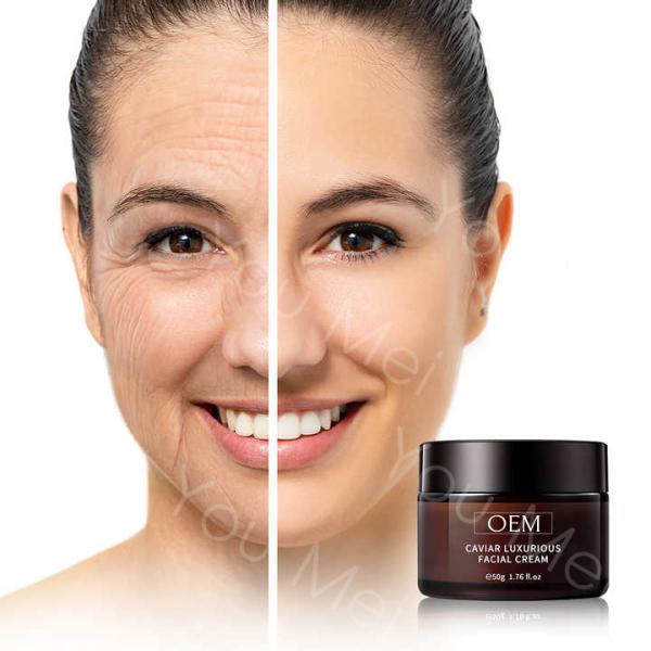 OEM Noche y día productos de crema facial de caviar botánico para eliminar las arrugas instantáneas promoviendo el colágeno