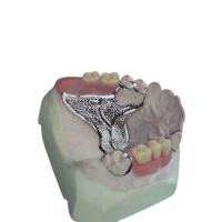 L'OEM fait sur commande a moulé la conception de haute résistance de numérisation de dentier partiel démontable