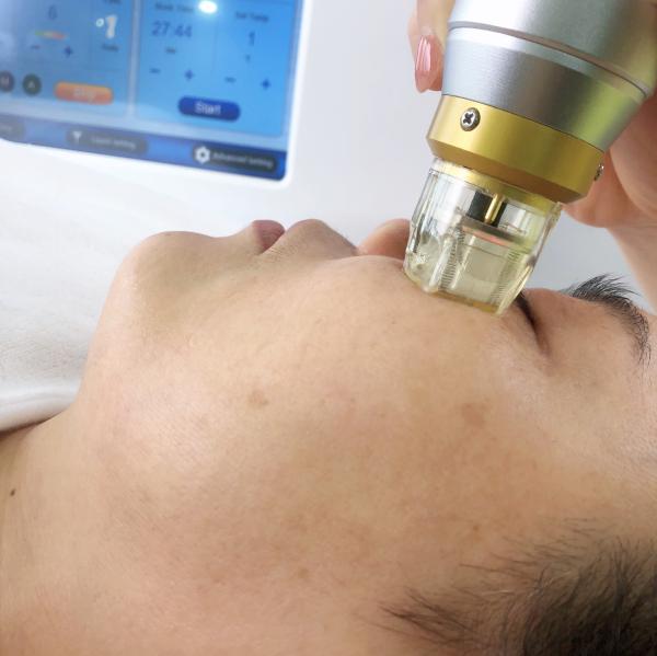 10,4 de” apertos fracionários da pele do levantamento de cara Microneedling RF