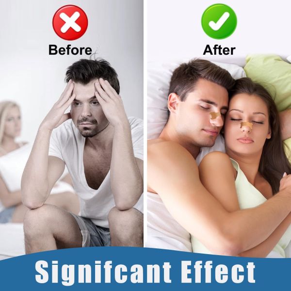 Cross-Border Strong Adhesive Brown Nose Breathing Strips Anti-Snoring Devices to Improve Sleep Ventilation