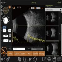 Formules multiples de calcul Digital du logiciel intelligent IOL de Mini Ultrasound Scanner Machine With