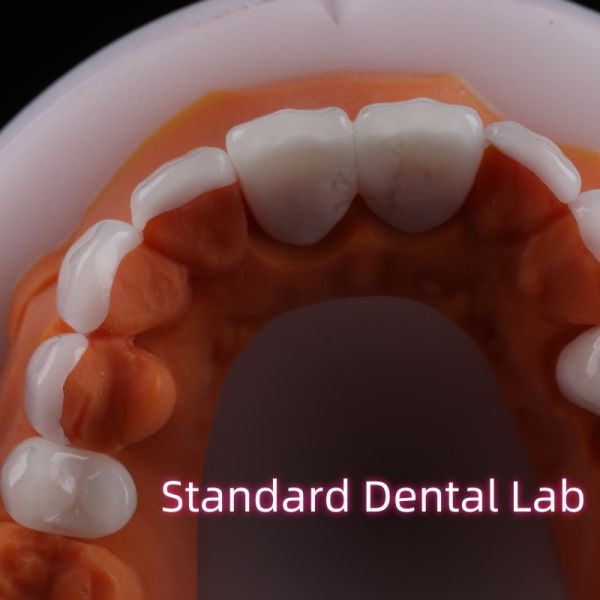 Устойчивый к абразии Emax Zirconia Ламинированные фанеры