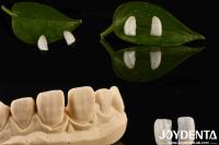 Alta durabilidad Micro carilla ultra delgada con madera natural de 0,2 mm de espesor
