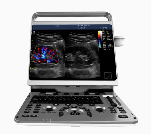 Portable Cardiac Ultrasound Machine Chison EBit 50 16.5lbs