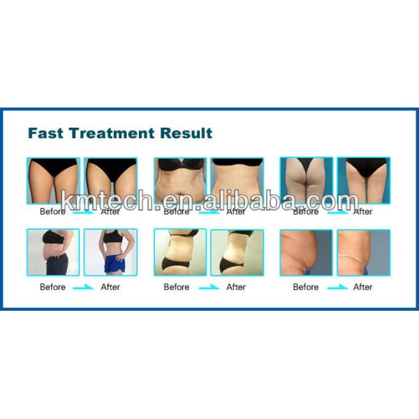 Система вакуумной кавитации 25 кГц 40 кГц Настольная машина для похудения