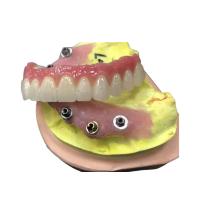 Couronne dentaire de zircone de butée d'implant naturelle tout sur quatre dentiers