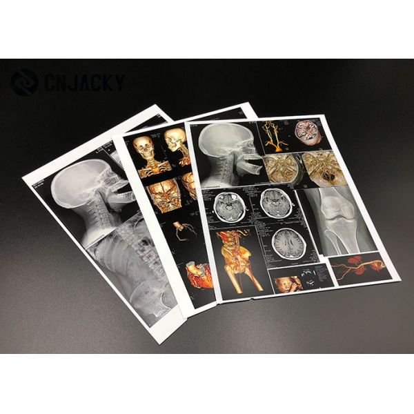 0.15mm Medical Radiation Printing Film