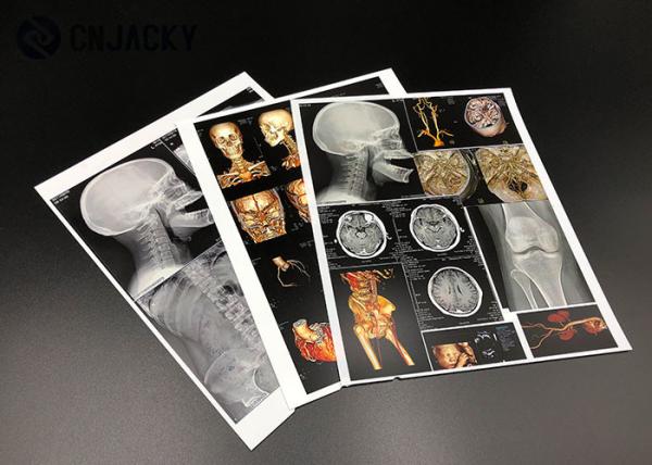 0.15mm Medical Radiation Printing Film