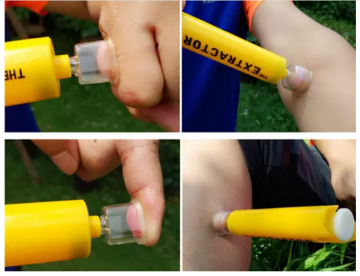 Bee Sting Snake Venom Extractor Kit Outdoor Hiking Traveling Emergency Poison Remove Pump Tools